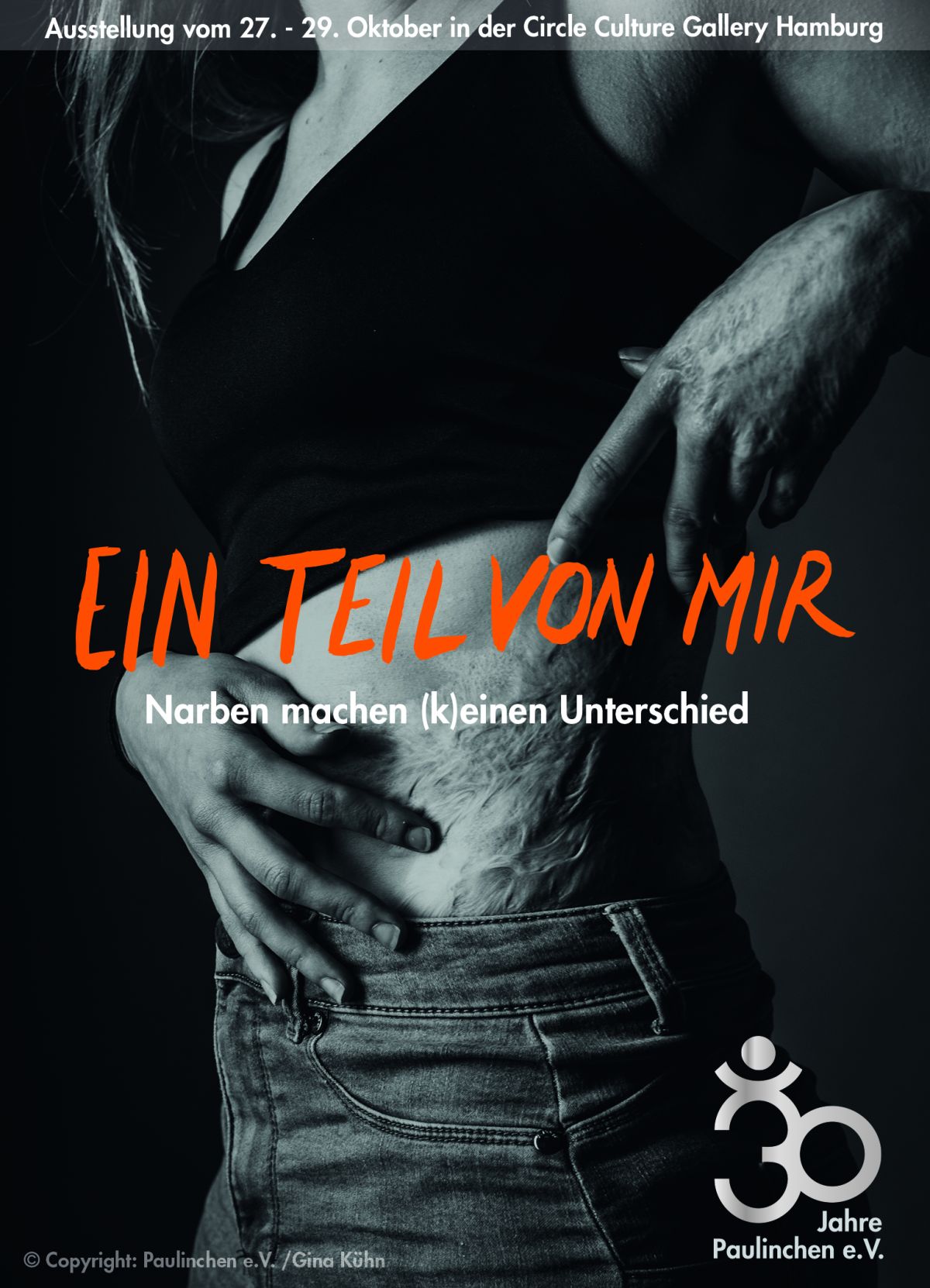 Fotoausstellung: „Ein Teil von mir – Narben machen (k)einen Unterschied“ Auf dem Bild ist der Oberkörper einer Frau in s/w zu sehen. Sie zeigt ihre Narben. Darüber steht in orangener Schrift: Ein Teil von mir.